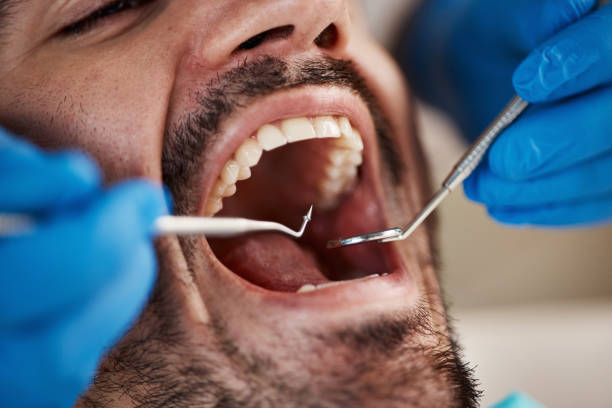 Best Weekend Emergency Dental Services in Bunker Hill, OR